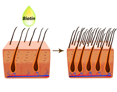 what is biotin therapy