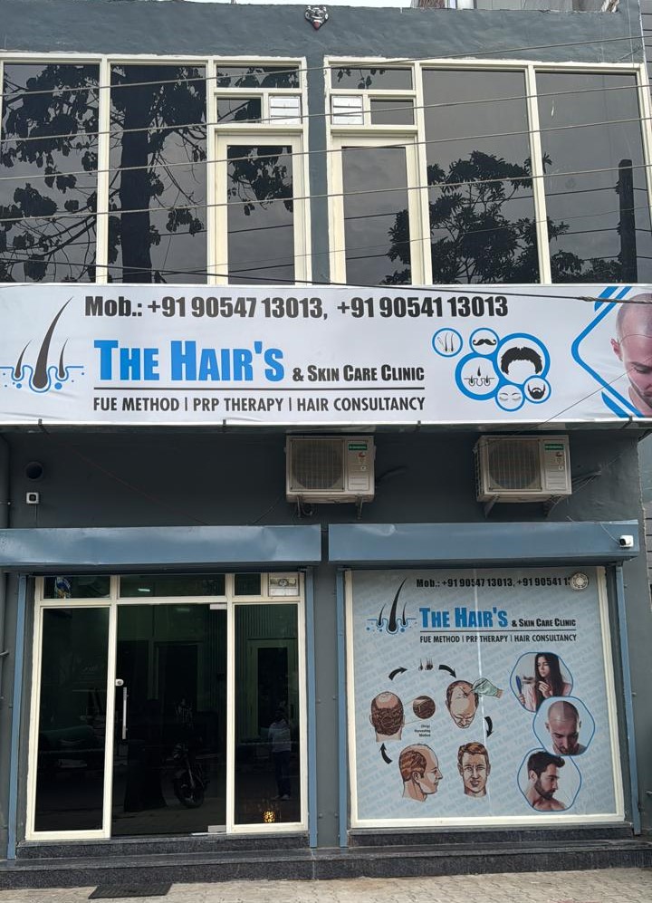 best hair transplant clinic in jalandhar